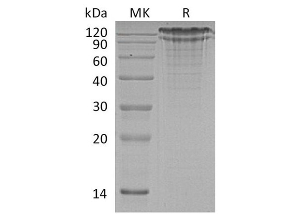 Human LDLR Recombinant Protein (RPES4265)