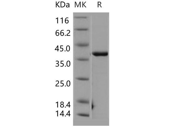 Human CSNK2A2/CK2A2 Recombinant Protein (RPES4271)