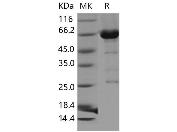 Mouse CDC37/CDC37A Recombinant Protein (RPES4274)