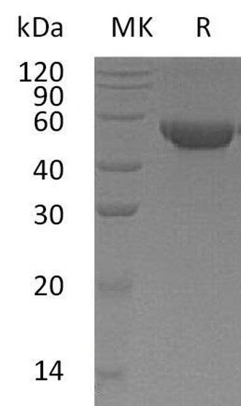 Human MGAT2/GlcNAc-TII Recombinant Protein (RPES4280)