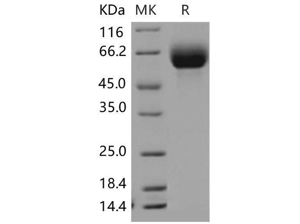 Mouse SLC3A2/CD98 Recombinant Protein (RPES4298)