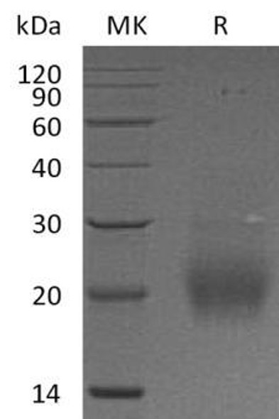 FSHB Recombinant Protein (RPES4303)