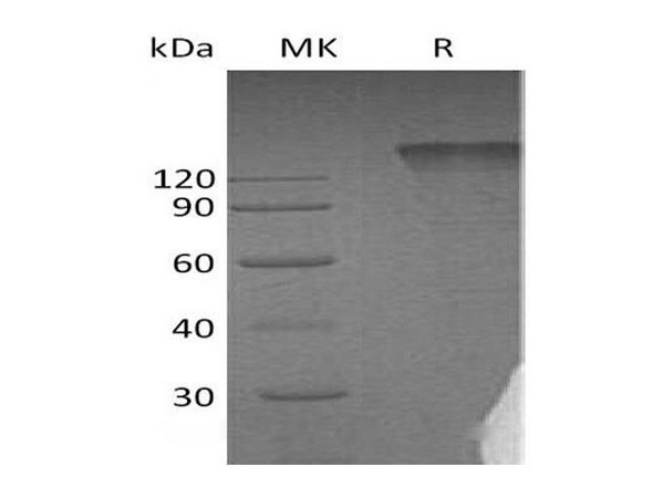 Human Semaphorin 4D/SEMA4D Recombinant Protein (RPES4330)