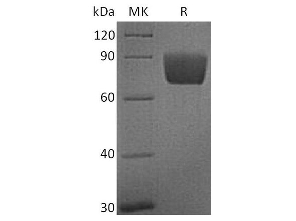 Human B7-H4/VTCN1 Recombinant Protein (RPES4341)