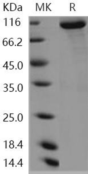 Human KEAP1/INRF2 Recombinant Protein (RPES4343)
