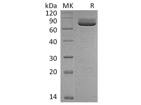 Rat CD73/NT5E Recombinant Protein (RPES4366)