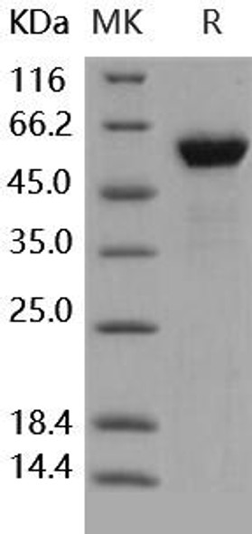 Human HMGB1/HMG1 Recombinant Protein (RPES4393)