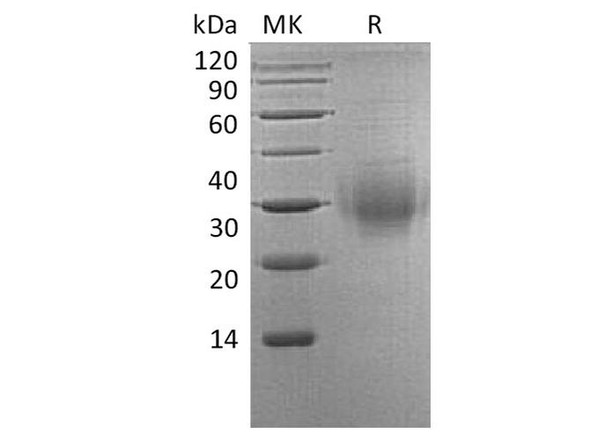Human BTLA/CD272 Recombinant Protein (RPES4412)