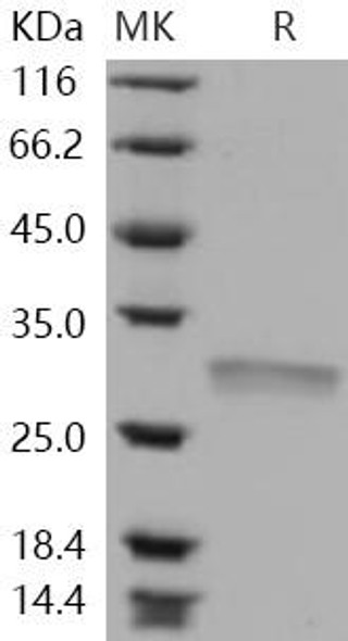Human RPE Recombinant Protein (RPES4436)