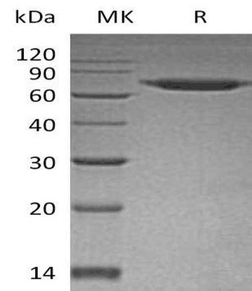 Human SENP8 Recombinant Protein (RPES4446)
