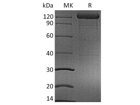 Human CD96 Recombinant Protein (RPES4455)