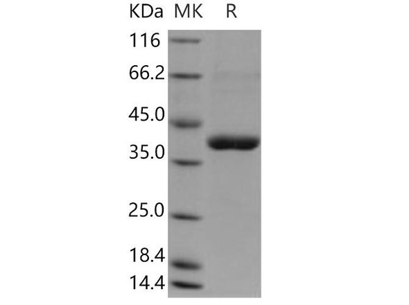 Human CANT1 Recombinant Protein (RPES4462)