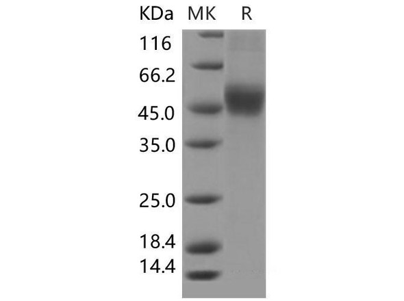 Mouse CD122/IL-2RB Recombinant Protein (RPES4483)