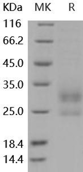 Mouse MD1 Recombinant Protein (RPES4491)