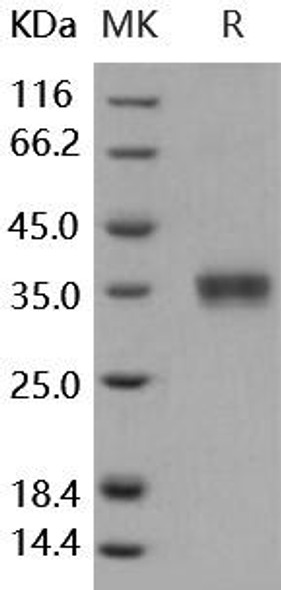 Human Granzyme B/GZMB Recombinant Protein (RPES4507)