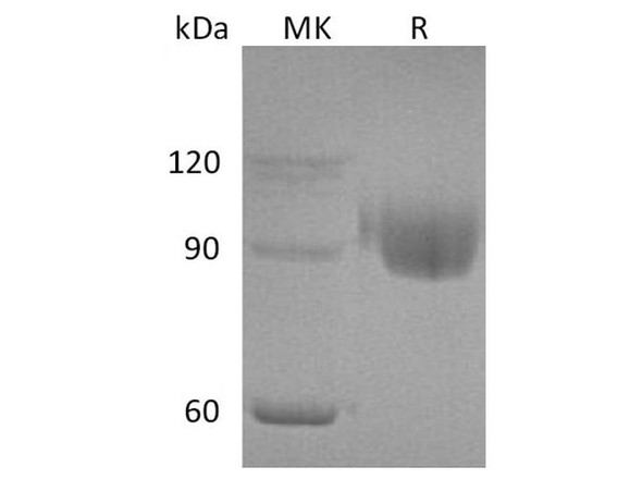 Human PIGR Recombinant Protein (RPES4519)