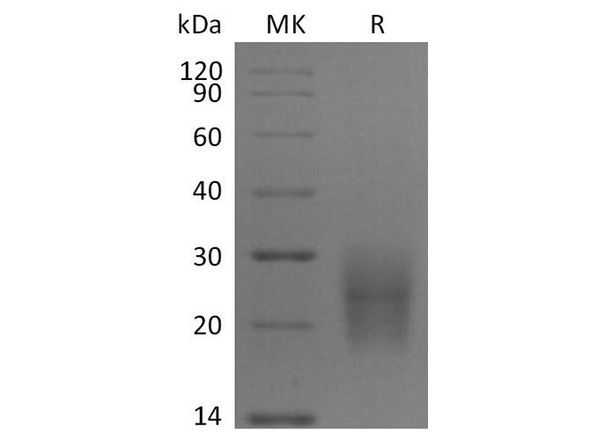 Human CD3d/CD3 delta Recombinant Protein (RPES4541)
