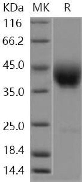 Human SLAMF6/Ly108 Recombinant Protein (RPES4544)