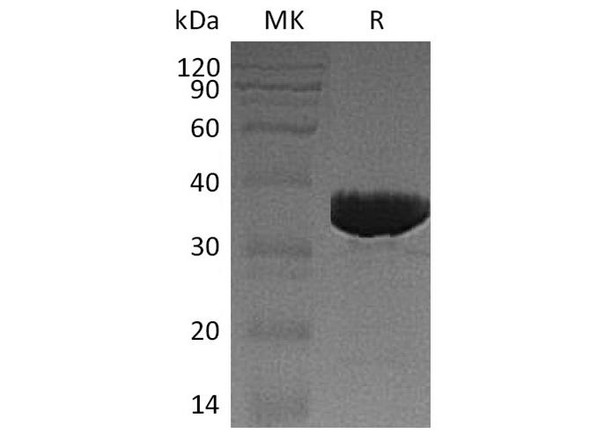 Human GALM Recombinant Protein (RPES4553)