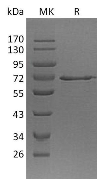 Human METAP2 Recombinant Protein (RPES4554)