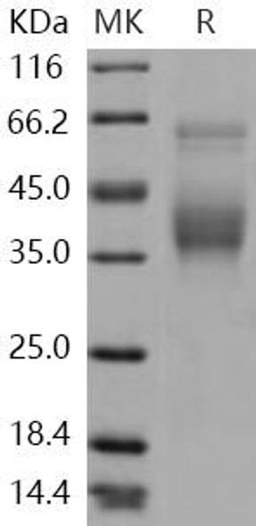 Human SLAMF6/Ly108 Recombinant Protein (RPES4564)