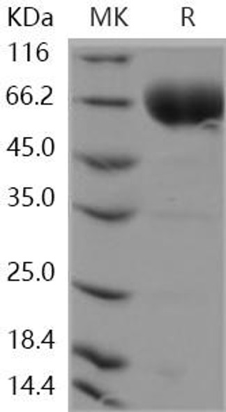 Human SLAMF6/Ly108 Recombinant Protein (RPES4585)