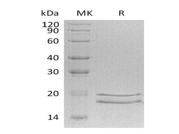 Human MCEE Recombinant Protein (RPES4594)