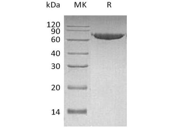 Human MMP-2 Recombinant Protein (RPES4601)