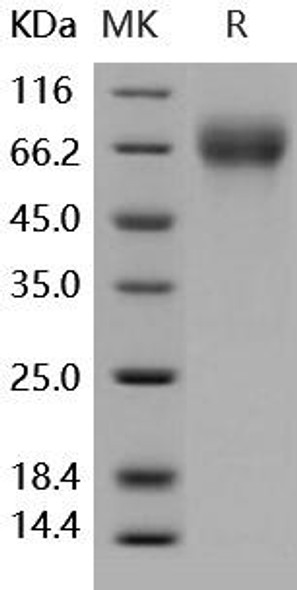 Human SerpinF2/SERPINF2 Recombinant Protein (RPES4628)