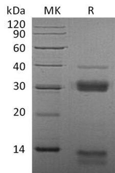 Mouse Cathepsin S/CTSS Recombinant Protein (RPES4630)