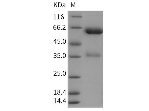 Rat EpCAM/TROP Recombinant Protein (RPES4648)