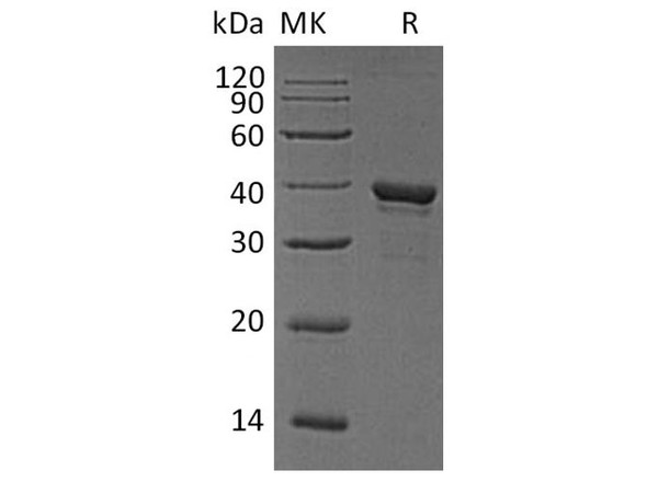 Human Arginase/ARG1 Recombinant Protein (RPES4663)