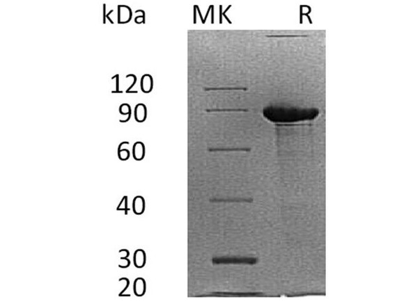 Human Syndecan/SDC1 Recombinant Protein (RPES4664)