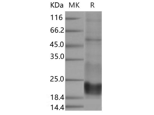 Human CD3 Epsilon/CD3E Recombinant Protein (RPES4667)