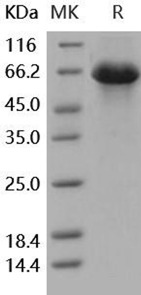 Human SerpinD1 Recombinant Protein (RPES4668)