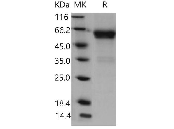 Mouse CD27/TNFRSF7 Recombinant Protein (RPES4671)