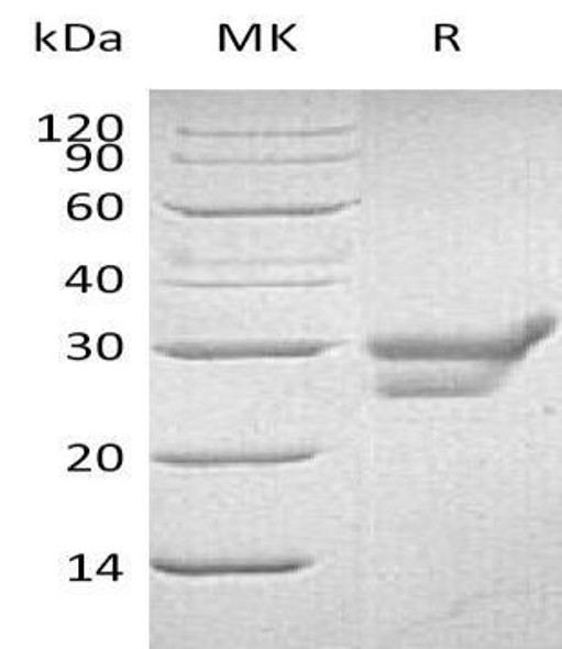 Human Cathepsin L/CTSL Recombinant Protein (RPES4674)