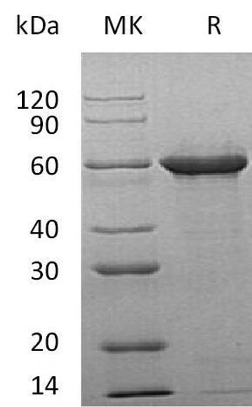 Human Tau-F Recombinant Protein (RPES4676)
