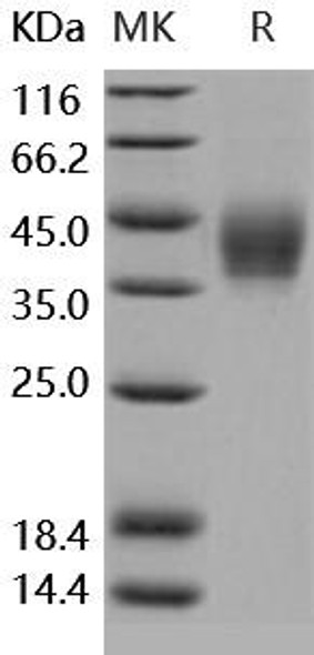 Human B7-DC/PD-L2/CD273 Recombinant Protein (RPES4689)