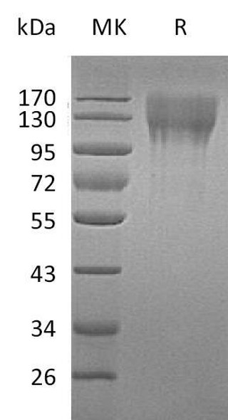 Mouse CD96 Recombinant Protein (RPES4691)