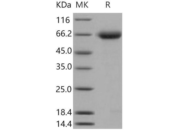 Mouse Nogo Receptor/NgR Recombinant Protein (RPES4692)