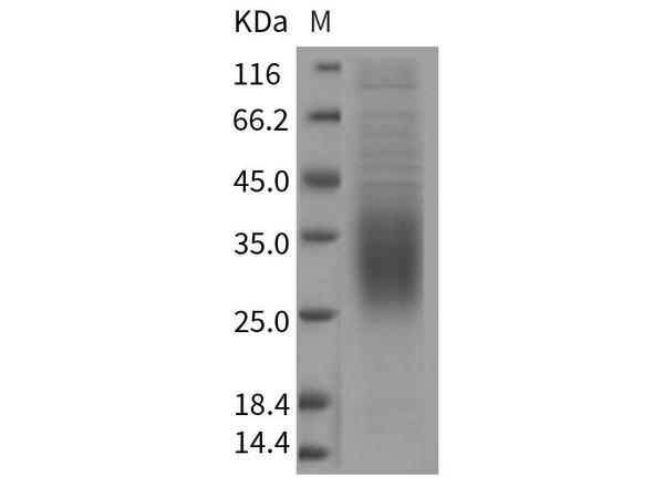 Rat CD47 Recombinant Protein (RPES4699)