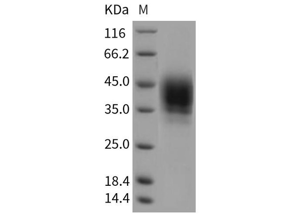 Rat CD48 Recombinant Protein (RPES4733)