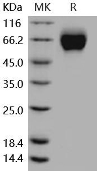 Mouse IL18R1/CD218a Recombinant Protein (RPES4779)