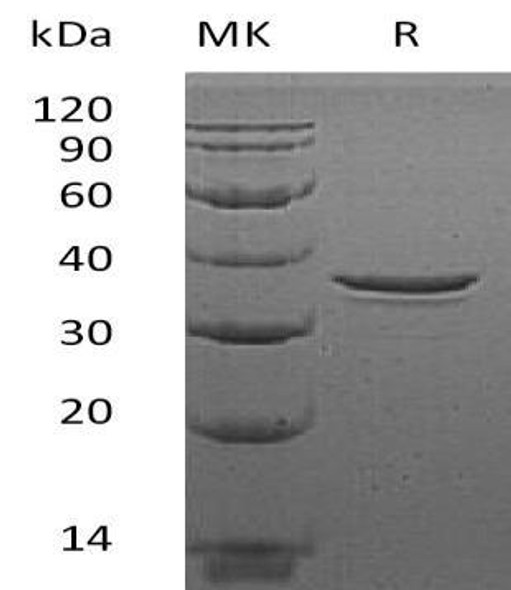 Human MORF4L2/MRGX Recombinant Protein (RPES4784)