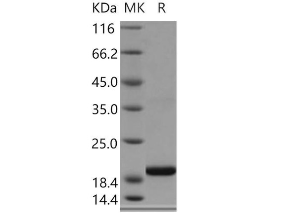Human SELM/Selenoprotein M Recombinant Protein (RPES4794)