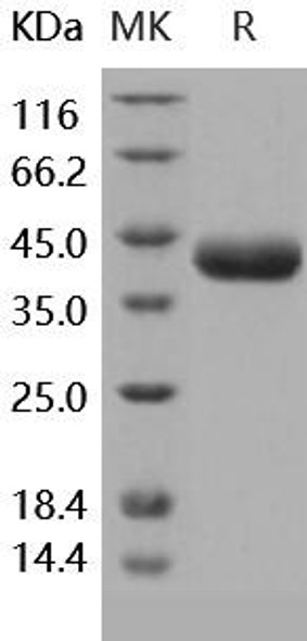 Human Prostasin/PRSS8 Recombinant Protein (RPES4797)