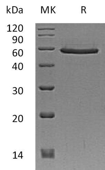 Human SMAD3 Recombinant Protein (RPES4825)