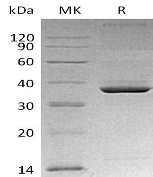 Mouse Apolipoprotein E/ApoE Recombinant Protein (RPES4828)
