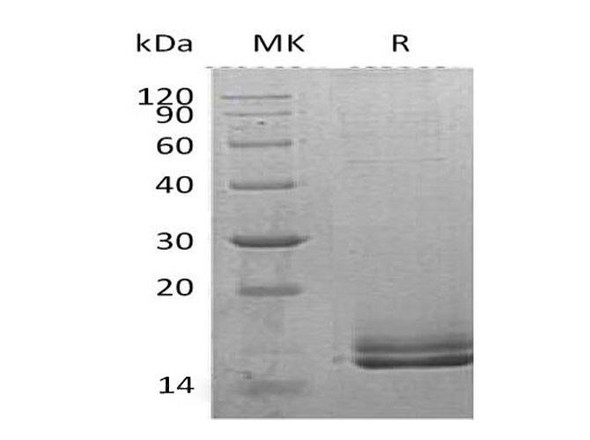 Human Motilin/MLN Recombinant Protein (RPES4845)